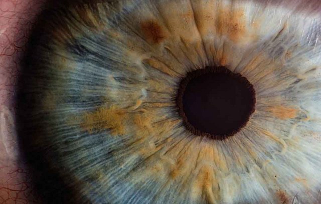 Was man über das Augenlasern wissen muss 